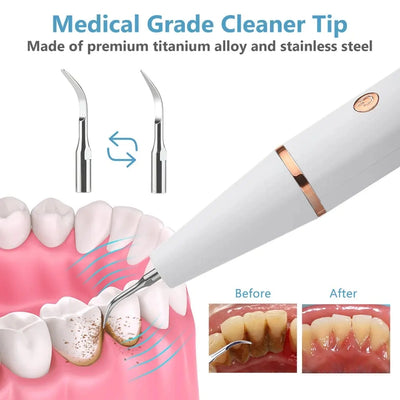 Ultra Sonic Dental Tooth Cleaner